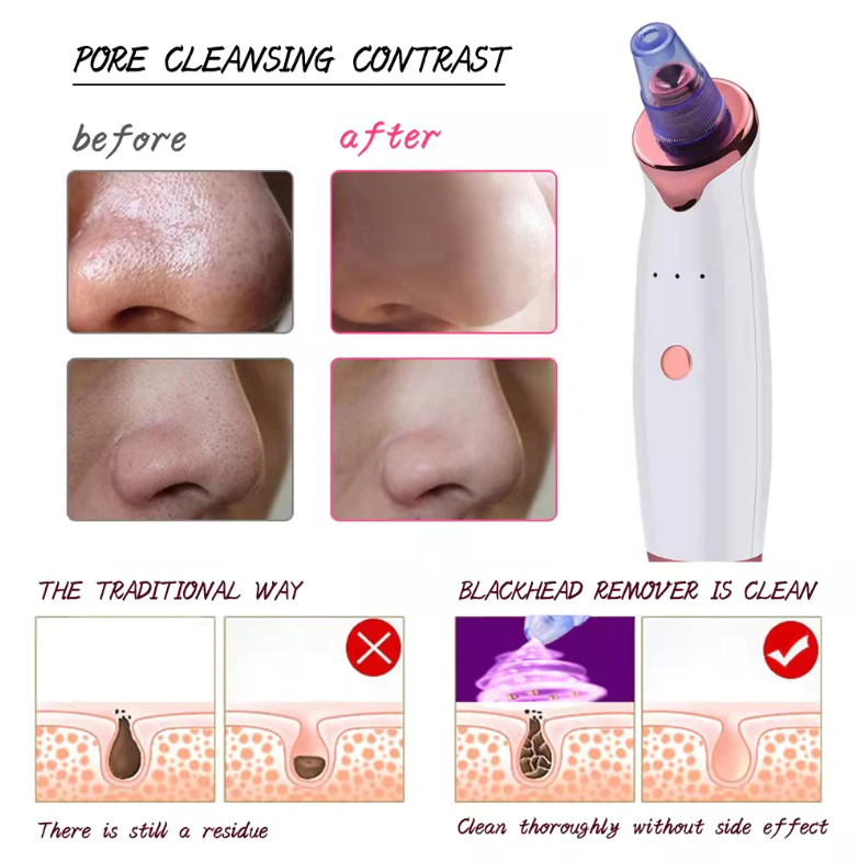 Blackhead Pore Cleaner
