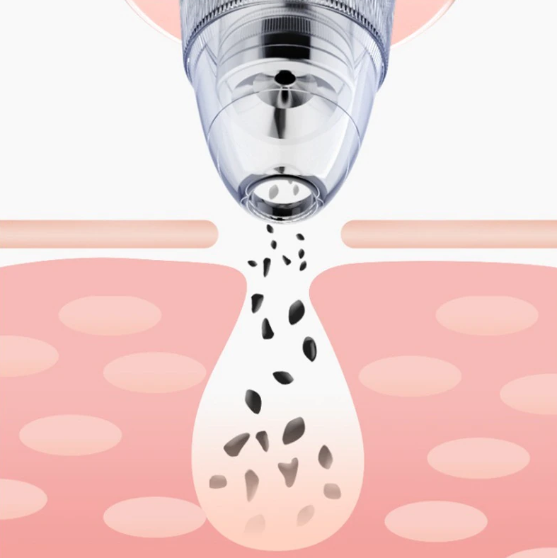 Blackhead Pore Cleaner